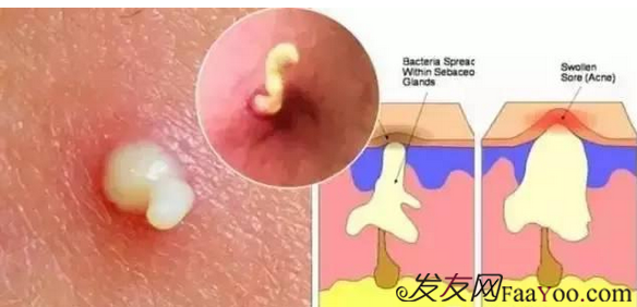 柿子醋上浮白色物体是什么-酿柿子醋坛子里面白色的像果冻的是什么? _感人网