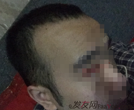 致力于头发时尚与健康|关于美发_植发_脱发_假