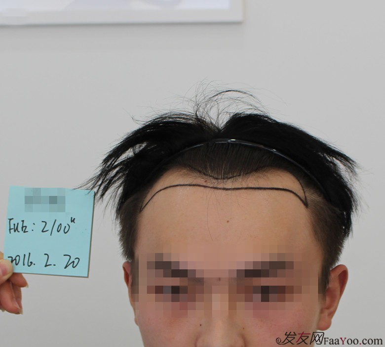 怎样能让头变大 112000yzahha7pg39i22h2.jpg