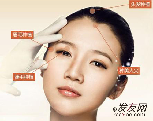 哪里植头发好,植头发手术前需要注意什么?_发