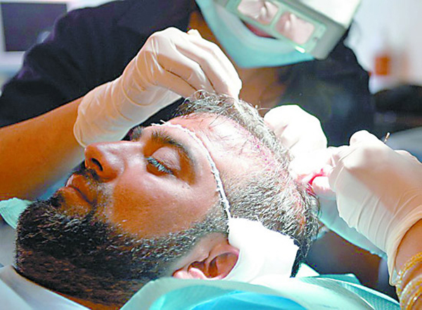 <em>植发后</em>多长时间可以<em>长出头发</em>?_发友网