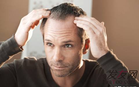 男性脱发和肾虚有关系吗？