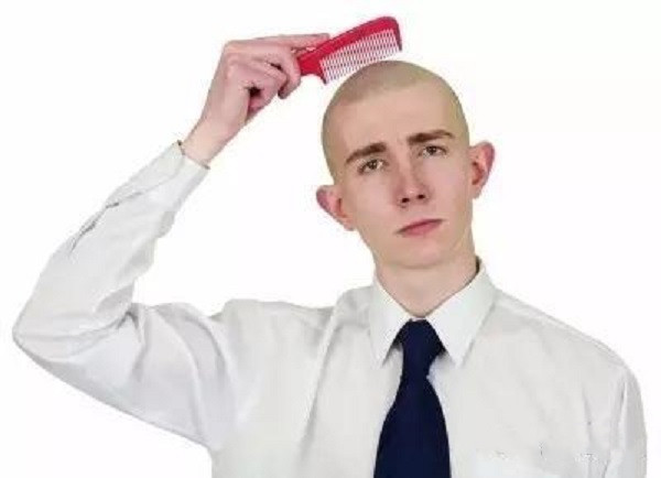 年轻男性容易患上脂溢性脱发的原因