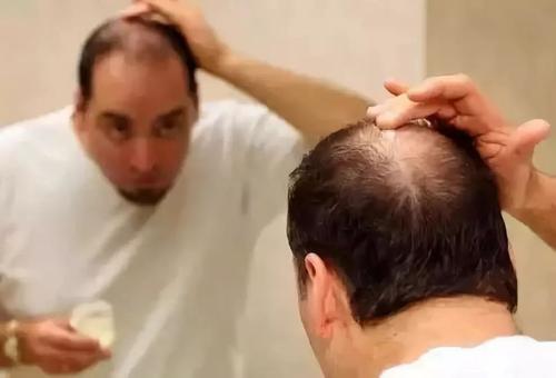 掉头发严重和肾虚有关系吗？