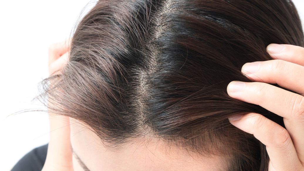 头发油腻应该怎么办？