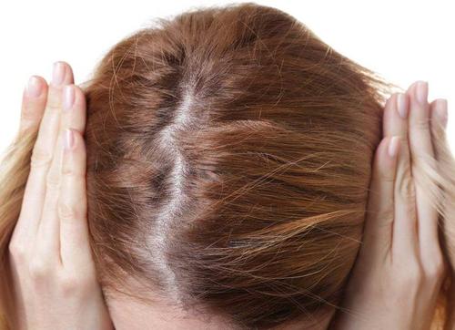 精神性脱发有痊愈的可能吗？