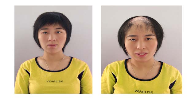 织发补发价格