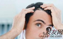 造成男性脱发掉发的原因都有哪些？