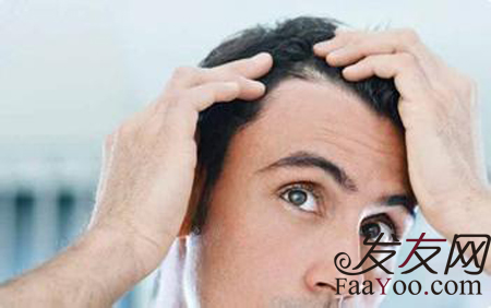 造成男性脱发掉发的原因都有哪些？文章图片展示