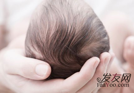 女性患上脂溢性脱发后该如何生发呢?