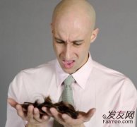 导致男人脱发的罪魁祸首是谁呢?