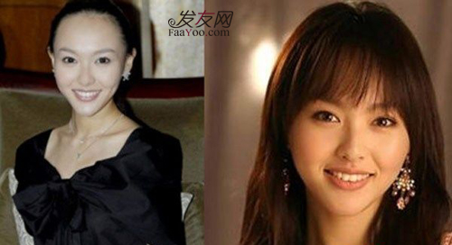 M头发应该怎么治疗,能恢复吗