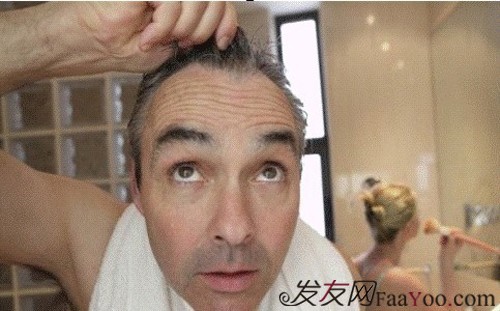 关于治男性脱发的偏方都有哪些?