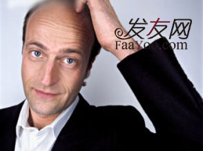 治疗肾虚性脱发的方法有哪些?