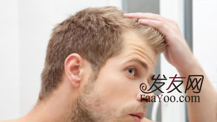治疗男性脱发管用的方法都有哪些呢?