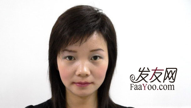 女性脱发治疗的方法都有什么呢?