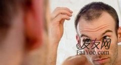 造成男性脱发的原因跟治疗的方法都有哪些？