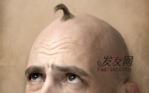 使用什么方法治疗男性脱发效果较好?