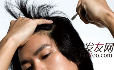 男性早秃的原因跟防止早秃方法有哪些?