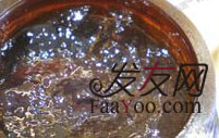 治疗男性脱发的方法都有什么呢?