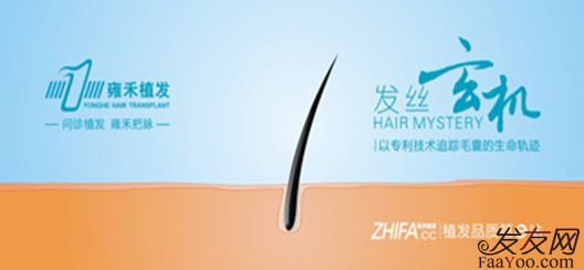 关于雍禾植发医院,雍禾植发怎么样?