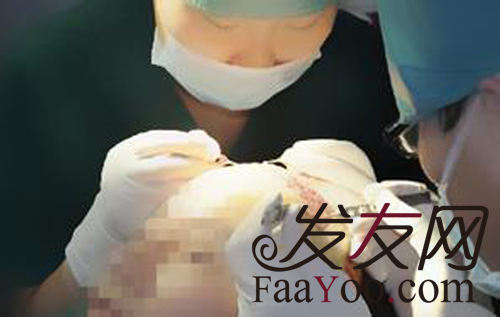 冬季植发的效果有影响吗?