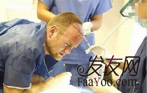 为什么国内植发技术要比国外好?