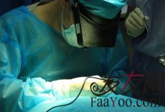 毛发移植的效果好吗可以相信吗?