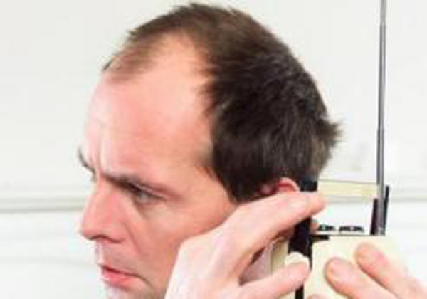 脱发都有哪些方法能够治疗呢?　