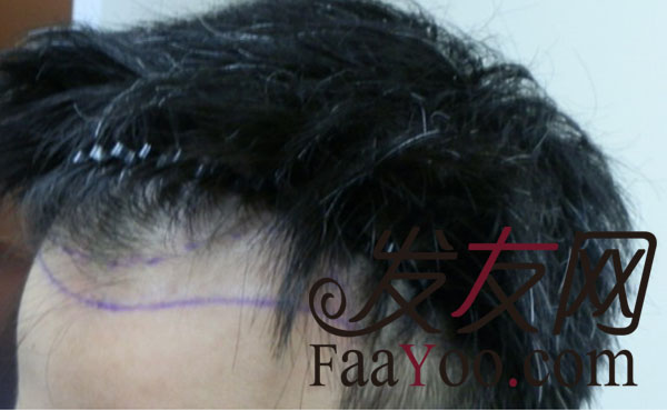 西安碧莲盛发迹线调整