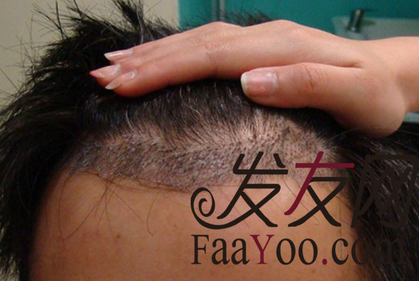西安碧莲盛发迹线调整