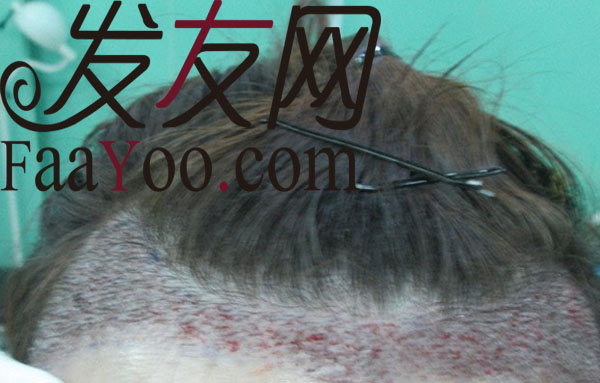 上海瑞丽诗植发(瑞丽诗毛发移植医院总部电话)