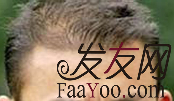 治疗男性脱发的方法都有哪些呢?