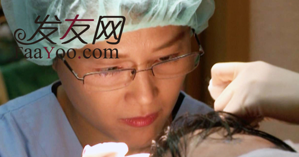 植发在多久后能够长出头发来呢?
