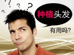植发的好处都有什么呢？