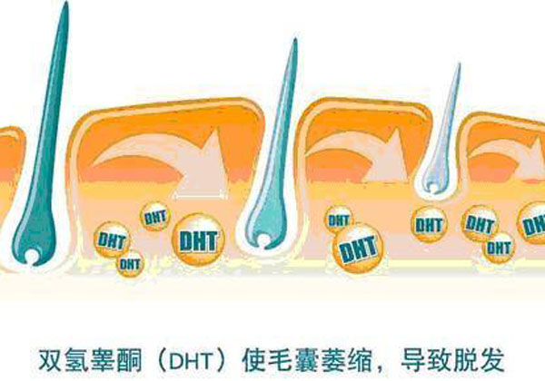 头发掉落应该怎样来护理？　