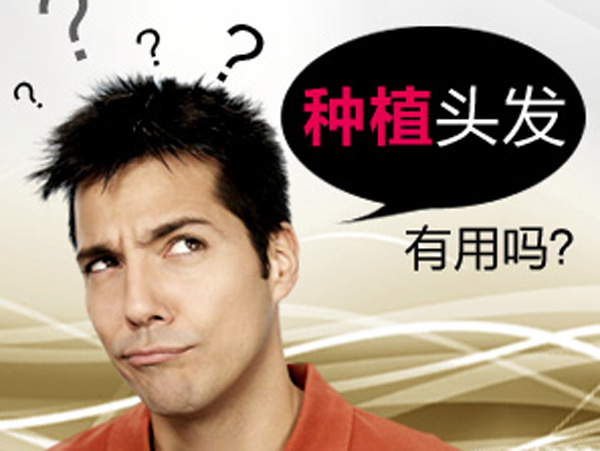 植发到底有没有效果?