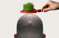 靠不靠谱脱发做植发？