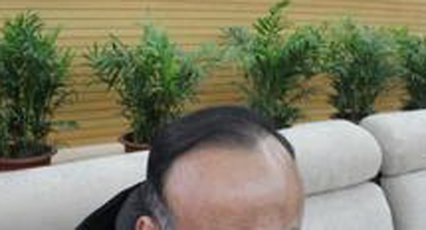 植发在冬季效果有影响吗?