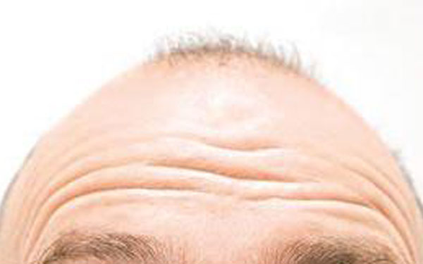 植发检查都有什么？　