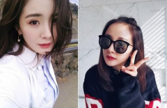 发际线清晰对女星的容貌影响