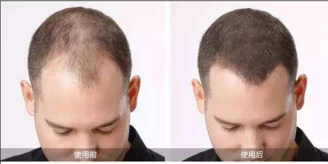 增发纤维粉真的不惧风雨吗?