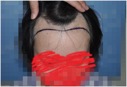 美女植发记,ZMHE2670单位