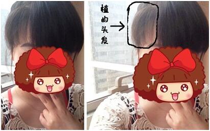 美女植发记,ZMHE2670单位