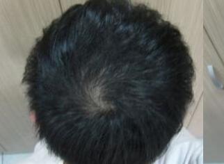 增发纤维粉跟头发纤维粉有区别么?