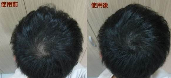 什么是密发纤维?