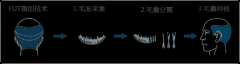 国内的植发技术FUE和FUT的区别！