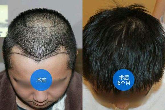 种头发图片2