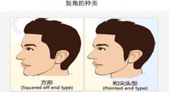鬓角种植让脸庞立体 更能提升男人魅力