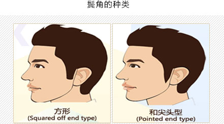 鬓角种植的四种样式图片1